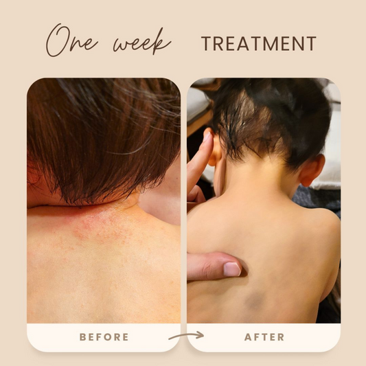 Itch Relief Cream 2 oz